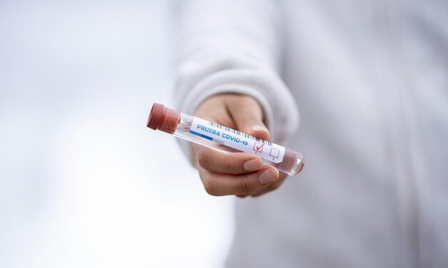 España realiza ha realizado más de 22,6 millones de Test PCR para detectar a los positivos por Covid